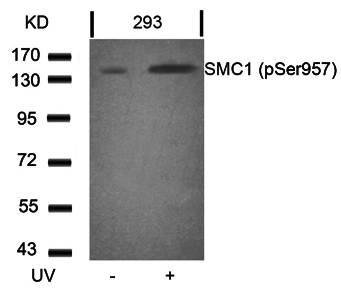 SMC1 (Phospho-Ser957) Antibody