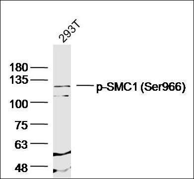 SMC1 (phospho-Ser966) antibody
