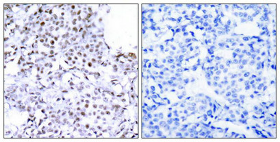 SMC1A (Ab-957) Antibody