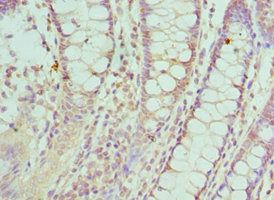 SMC1A Antibody