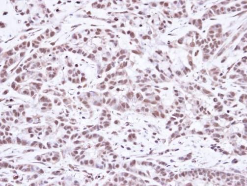 SMC1A antibody [N1N2], N-term
