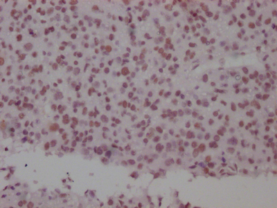 SMC1A Recombinant Monoclonal Antibody