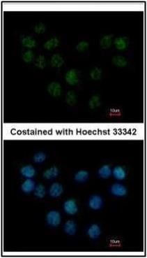 SMC1B Rabbit Polyclonal Antibody