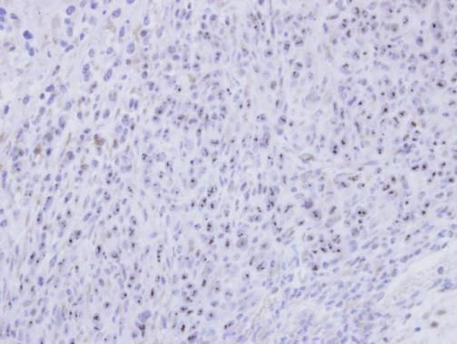 SMC1B Rabbit Polyclonal Antibody
