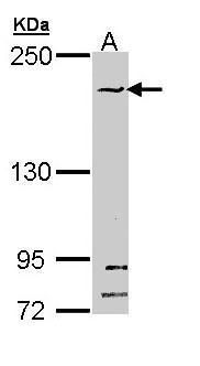 SMC1B Rabbit Polyclonal Antibody