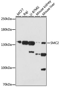 SMC2 antibody