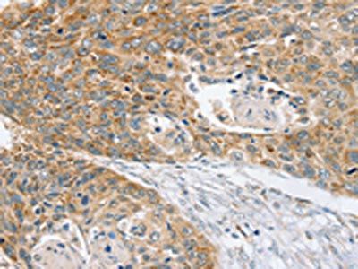 SMC4 Antibody