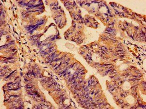 SMC4 Antibody