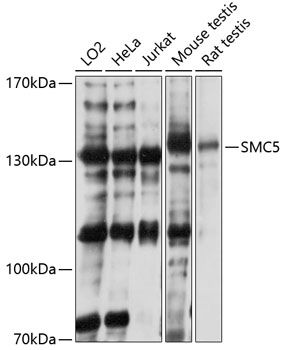 SMC5 antibody