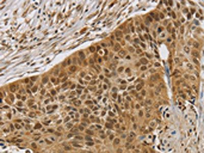 SMC6 Antibody