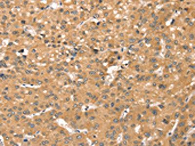 SMC6 Antibody