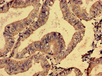 SMG6 Antibody