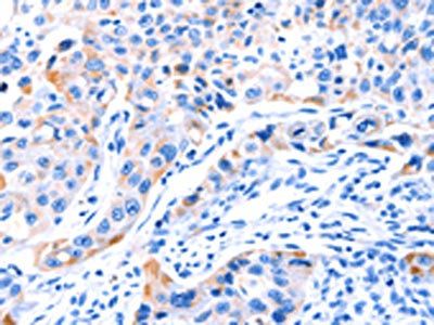 SMG8 Antibody