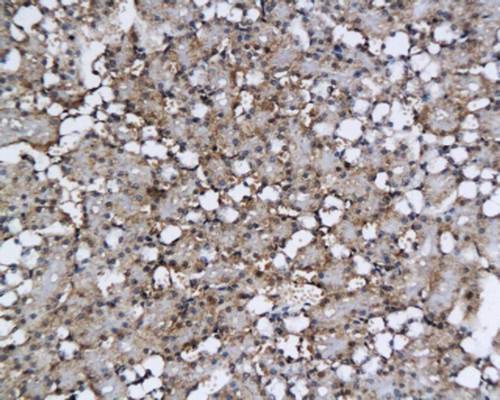Heavy chain cardiac Myosin Rabbit Polyclonal Antibody