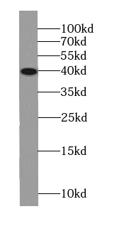 SMN-Exon7 antibody