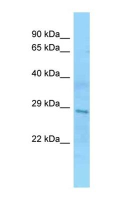SMN2 antibody