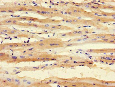 SMNDC1 Antibody
