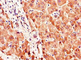 SMO Antibody