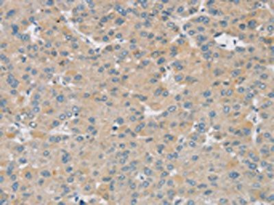 SMOC2 Antibody