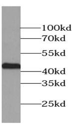 smooth muscle actin specific antibody