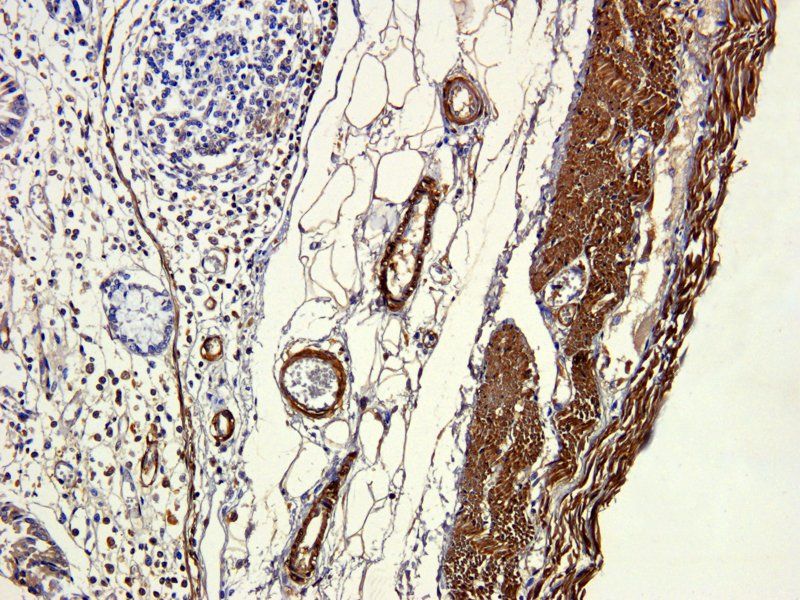 ACTA2 antibody