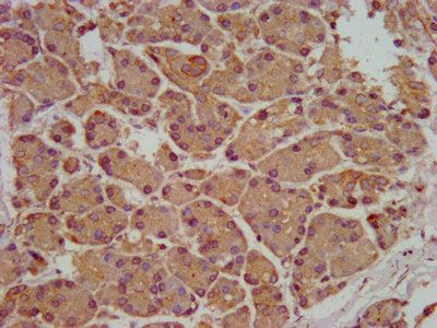 SMPD2 Antibody