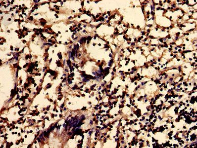 SGMS2 Antibody
