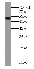 Smtnl1 (phospho-S301) antibody