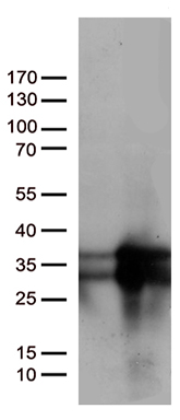 SMURF 2 (SMURF2) antibody