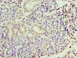 SMYD4 antibody