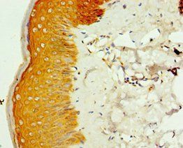 SMYD4 antibody