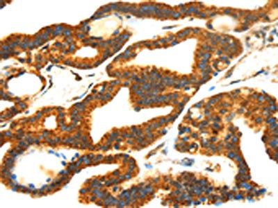SMYD4 Antibody