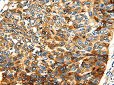 SMYD4 Antibody