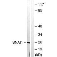 SNAI1 (Ab-246) antibody
