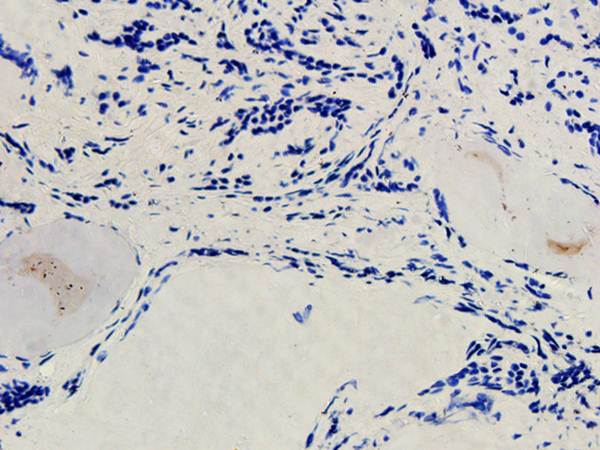 SNAIL Rabbit Polyclonal Antibody
