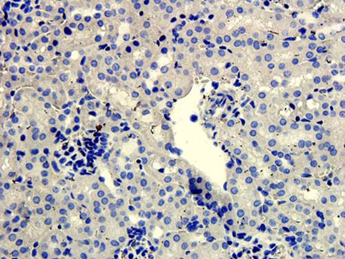 SNAIL Rabbit Polyclonal Antibody