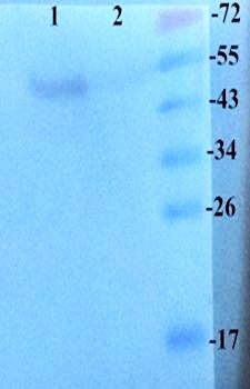 SNAIL Rabbit Polyclonal Antibody