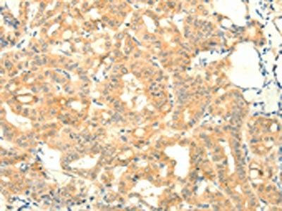 SNAP25 Antibody