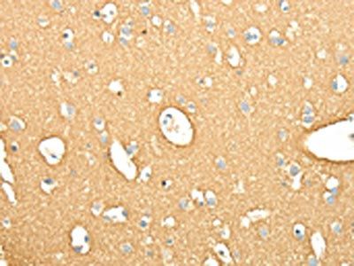 SNAP25 Antibody