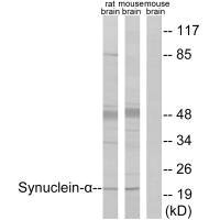 SNCA (Ab-125) antibody