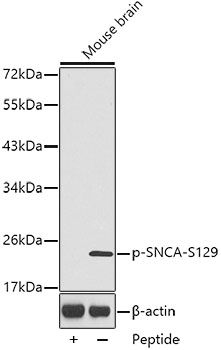 SNCA (Phospho-S129) antibody