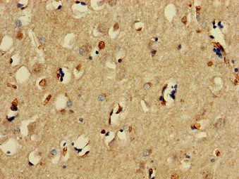 SNCAIP Antibody