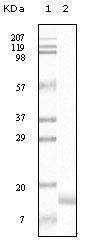 SNCG (breast cancer-specific protein 1) Antibody
