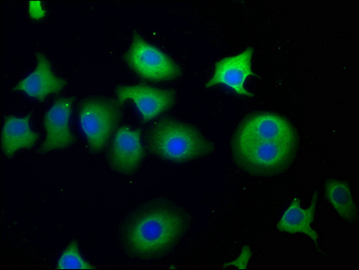 SNF8 antibody