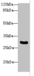 Snrnp35 antibody