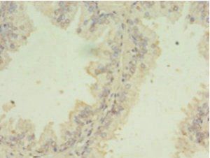 SNRPB2 Antibody