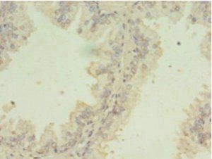 SNRPB2 antibody