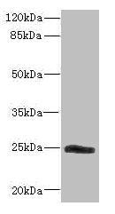 SNRPB2 Antibody