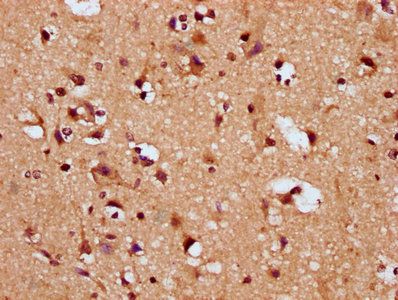 SNRPE Antibody