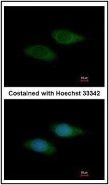 SNTB2 antibody [N2C3-2]